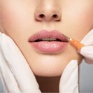 Lip Fillers - Aftercare